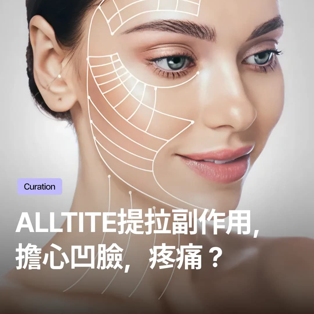 Alltite提拉副作用，擔心凹臉，疼痛？術前必看注意事項總整理