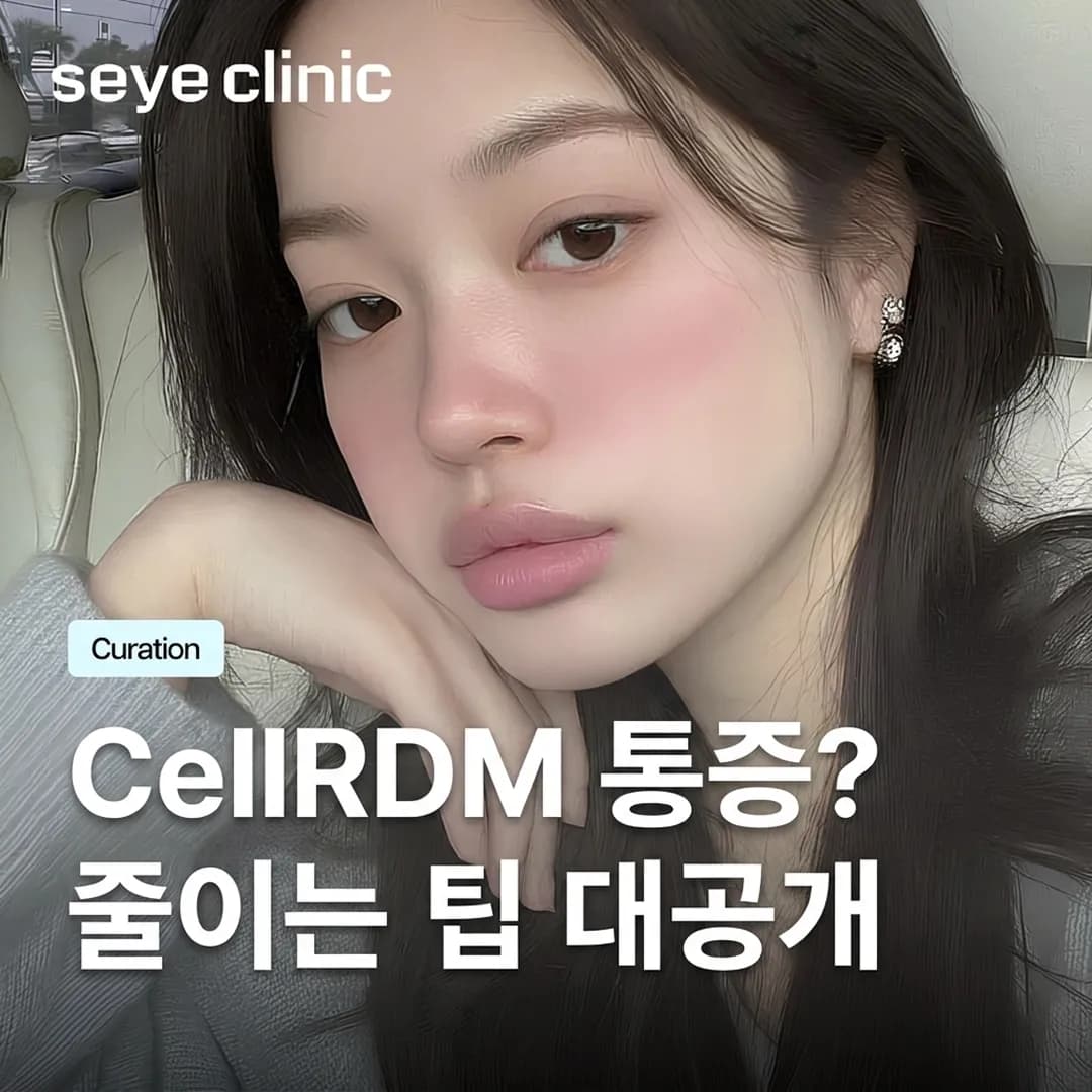 셀르디엠 통증: 다운타임 최소화 및 통증 관리 완벽 가이드