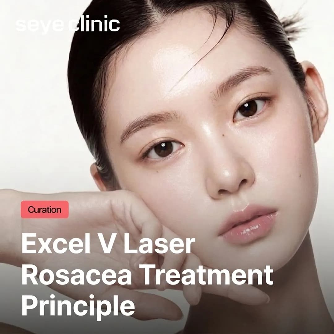 Excel V Laser in Seoul: How to Effectively Treat Rosacea and Redness