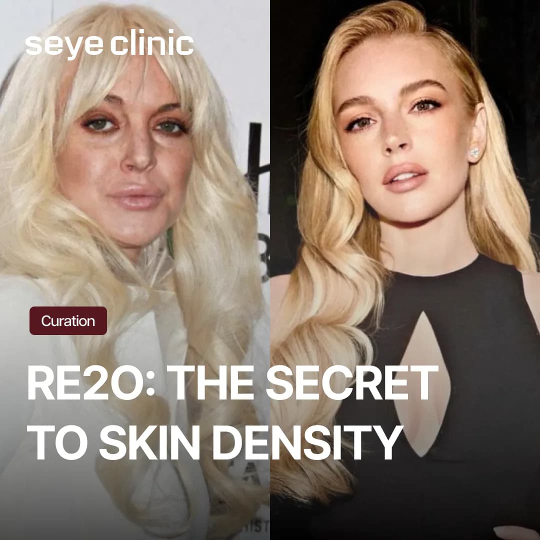 Is Re2O the Korean Renuva? Why Lindsay Lohan’s Choice Isn't Available in Korea and the Best Alternative