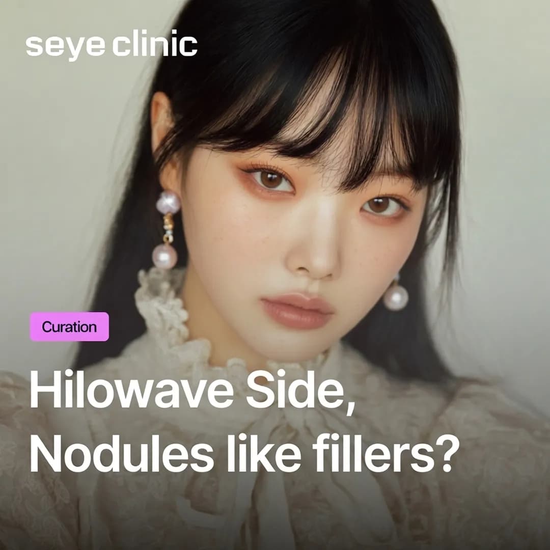 HiloWave Side Effects: Worried About Lumps Like Fillers? (A Safety Guide)