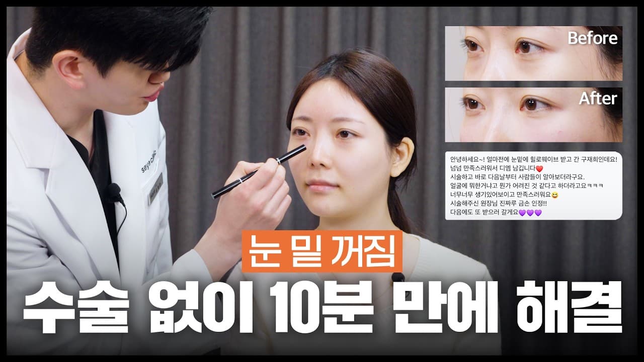 꺼진 부분만 티 안나게 채우는, 금손 원장님의 테크닉 보고 가세요🤓 #올타이트 #힐로웨이브 #올타이트연구자문병원