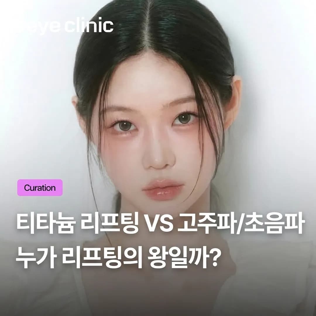 강남 티타늄 리프팅: 고주파(RF) 및 초음파(HIFU)와의 완벽 비교 가이드