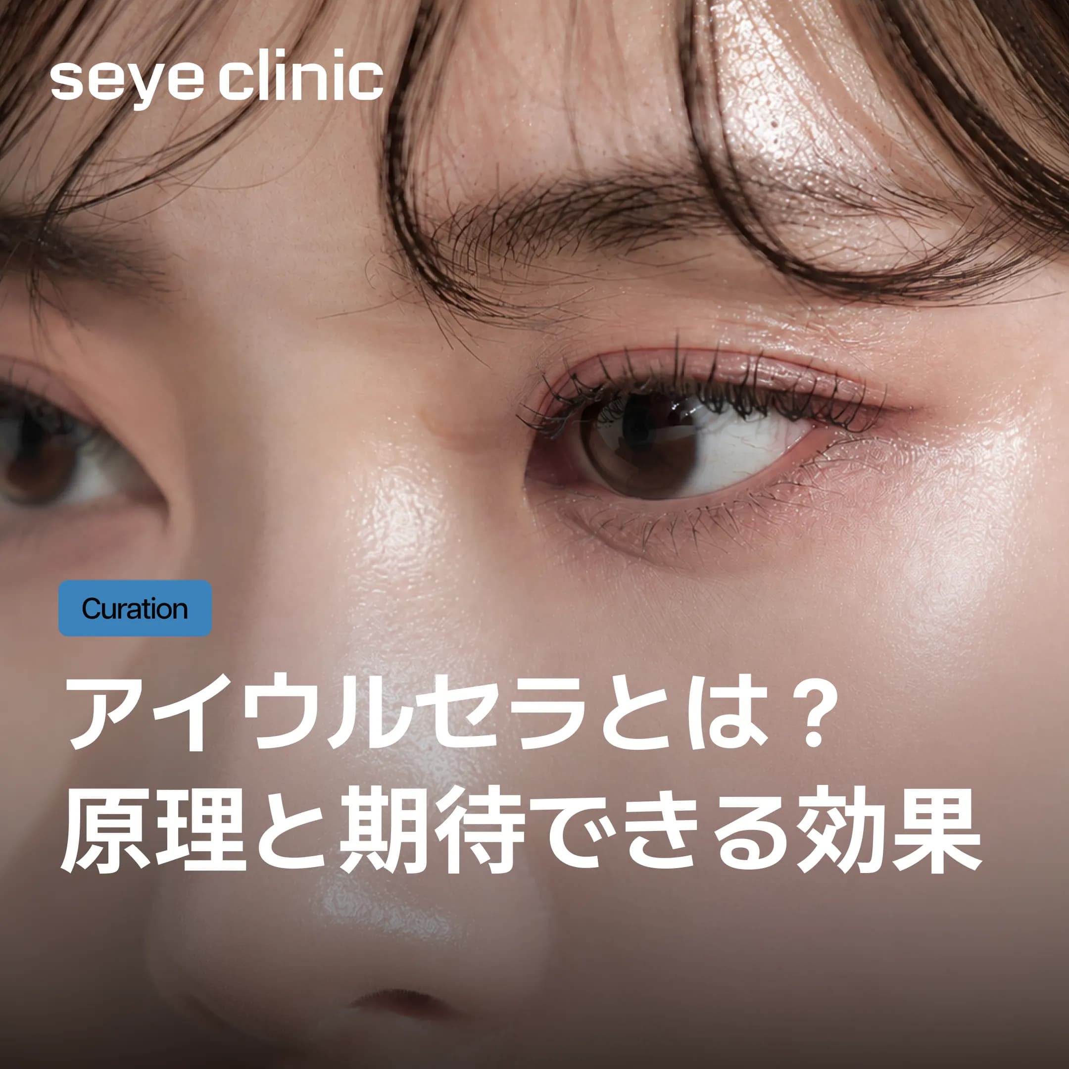 アイウルセラとは?目元のたるみを引き締める原理と効果