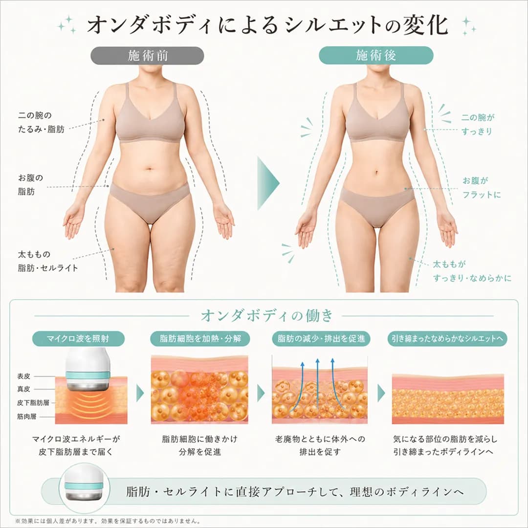 オンダボディによるシルエットの変化.