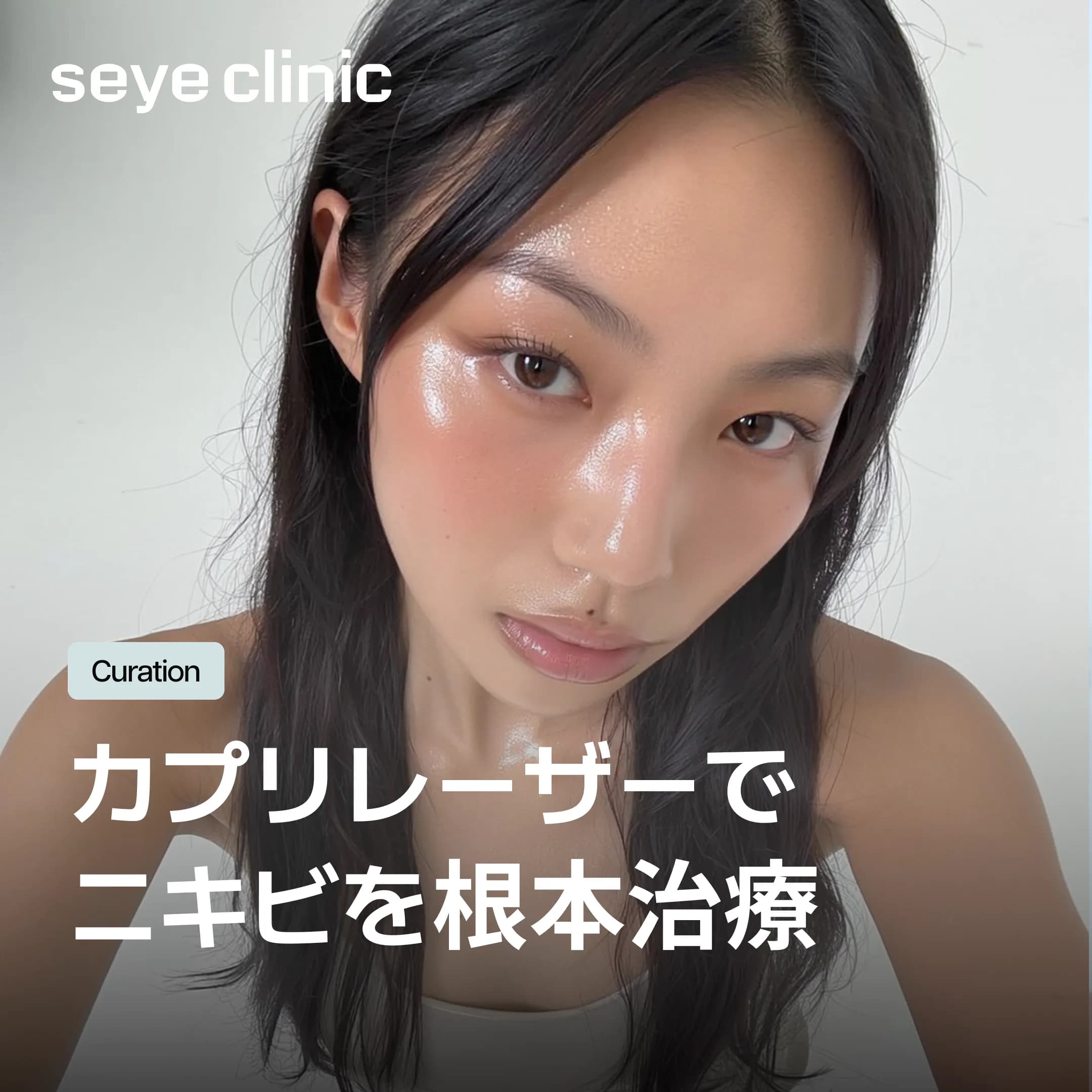 カプリレーザーで根本的なニキビ治療!効果とダウンタイムを解説