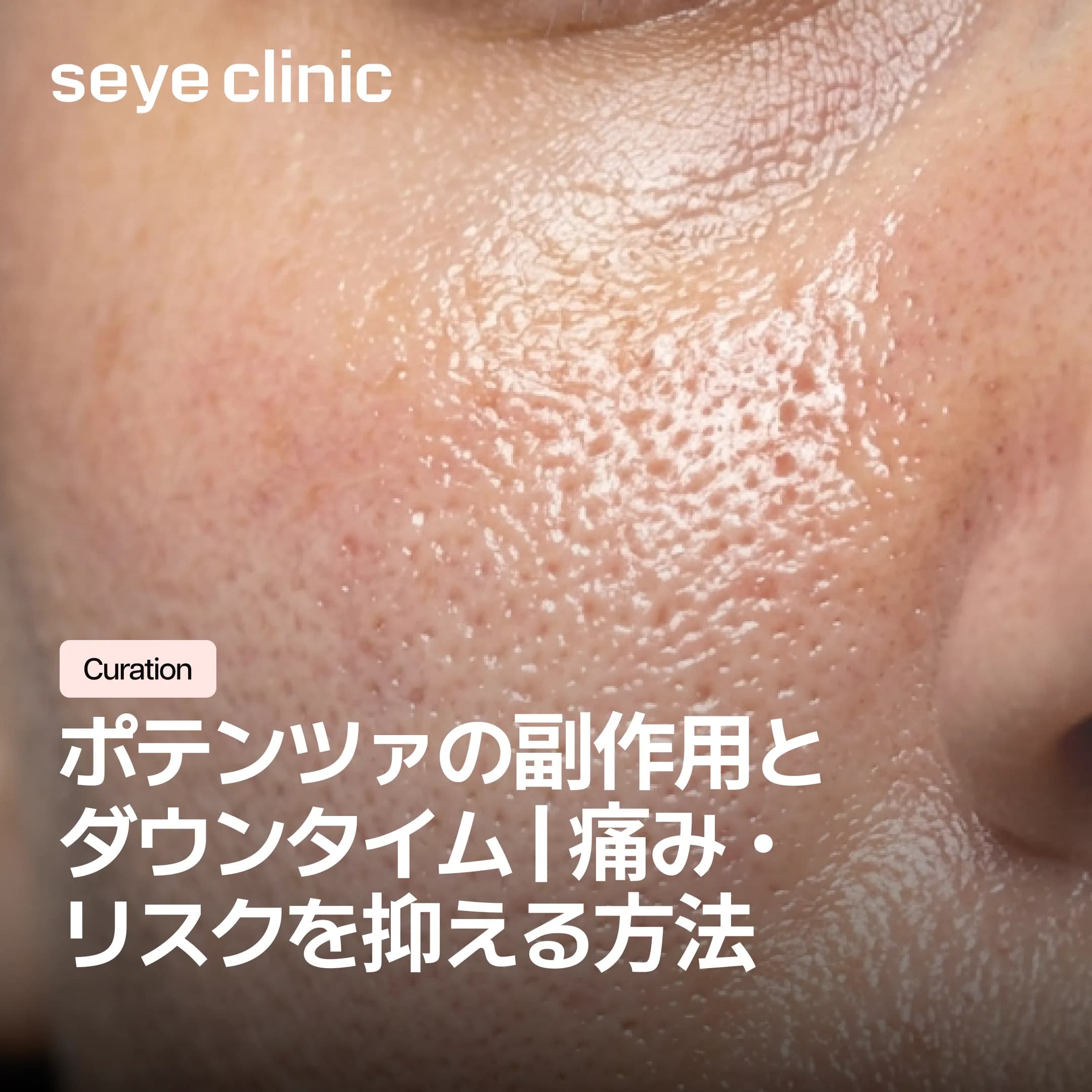 ポテンツァの副作用とダウンタイム | 痛み・リスクを抑える方法