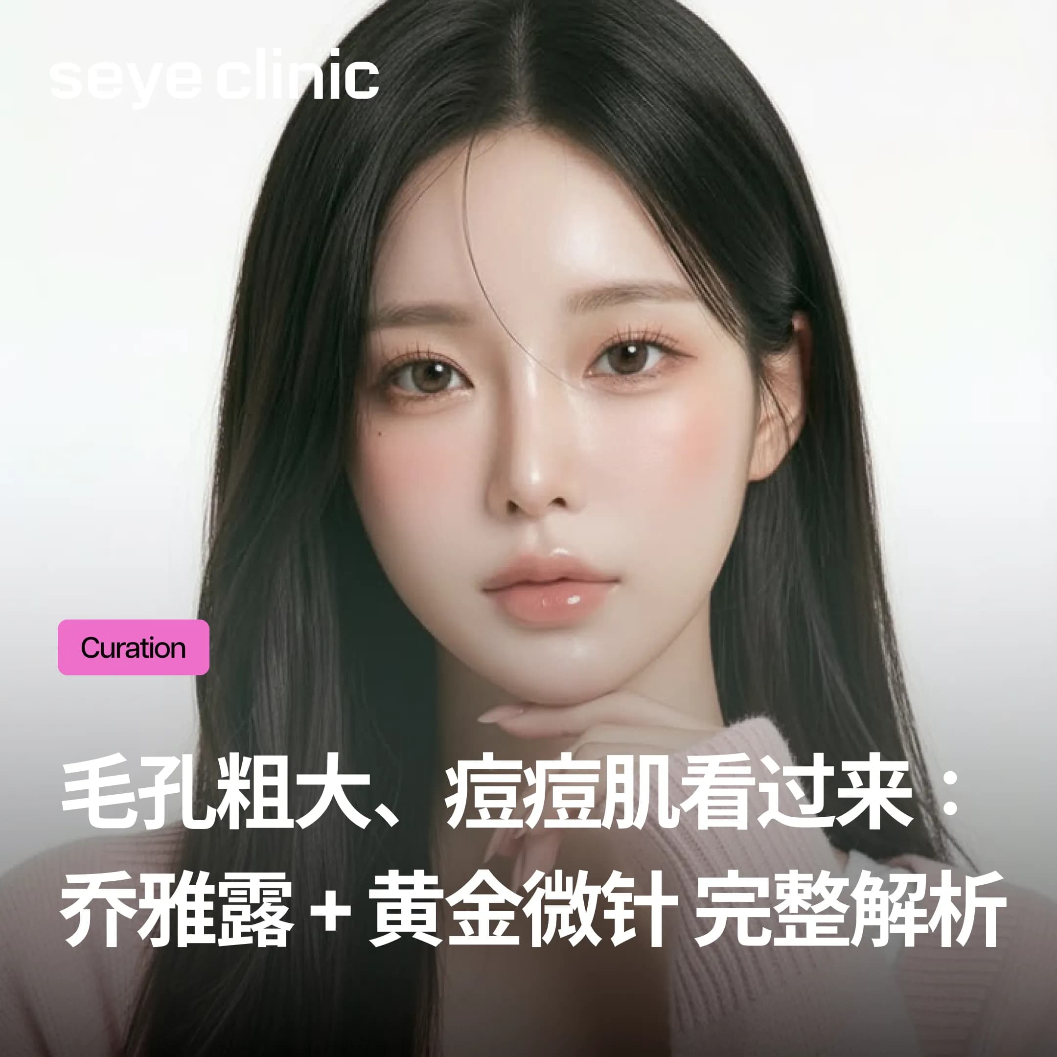 毛孔粗大、痘痘肌看过来:Juvelook乔雅露+黄金微针Potenza 复合疗程完整解析