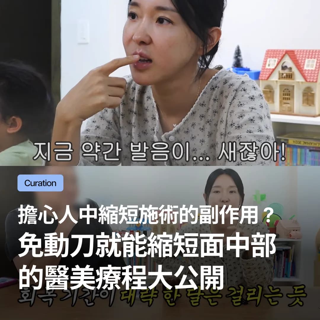 擔心人中縮短施術的副作用?免動刀就能縮短面中部的醫美療程大公開