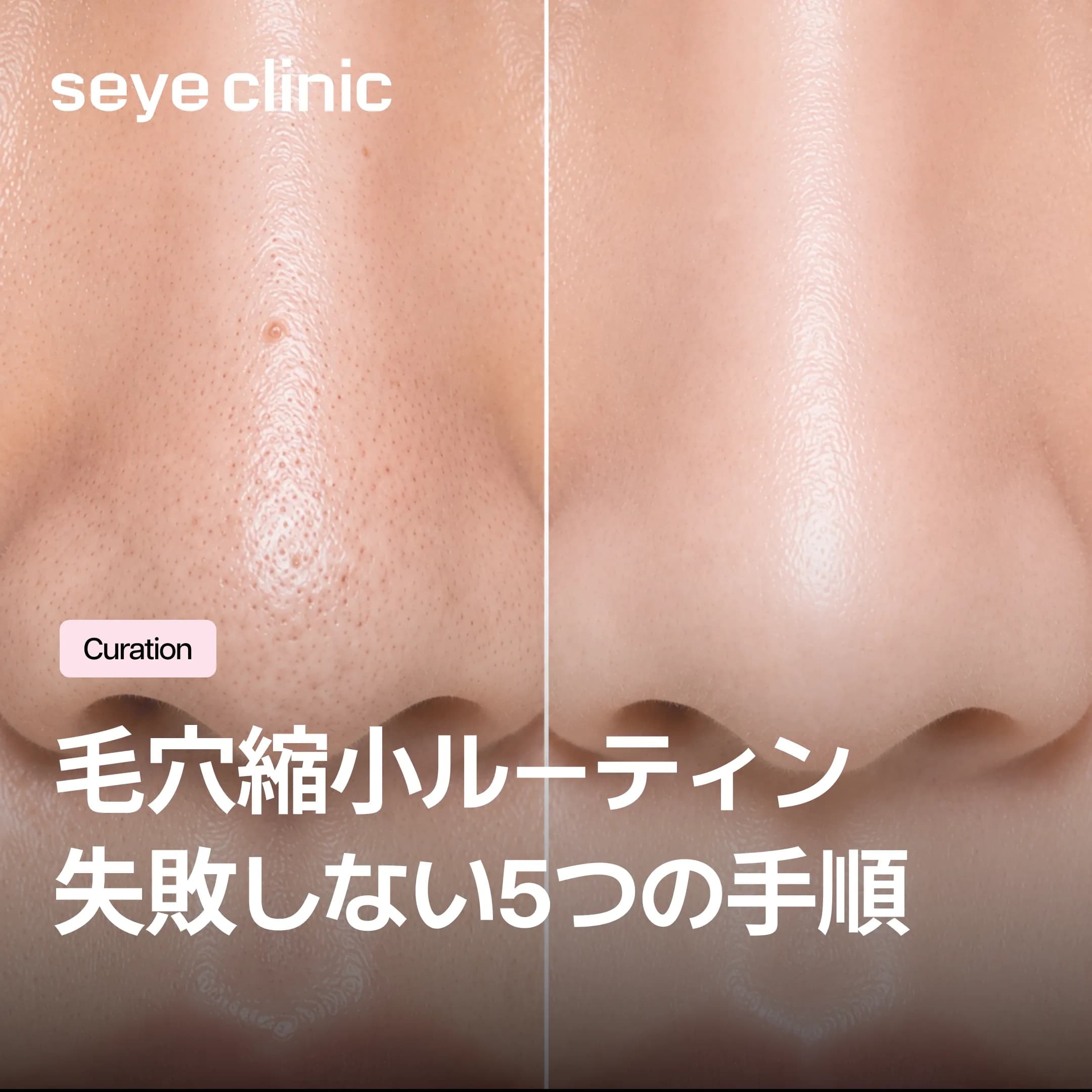 失敗しない毛穴縮小の完全ルーティン!アクアピールからエラビエRe2Oまで解説