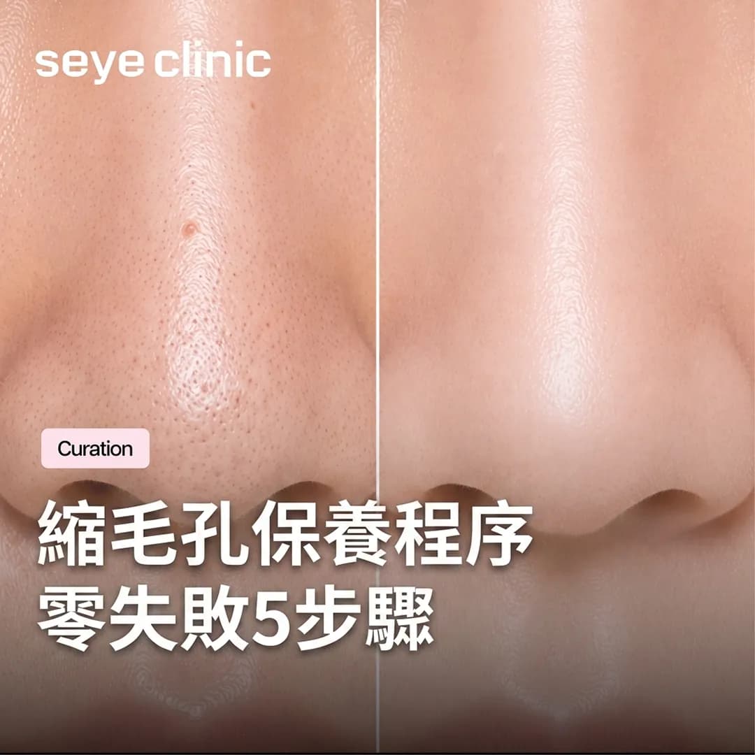 韓國醫美首爾皮膚科推薦:零失敗縮毛孔保養程序!從水氧煥膚到Elravie Re2O全解析