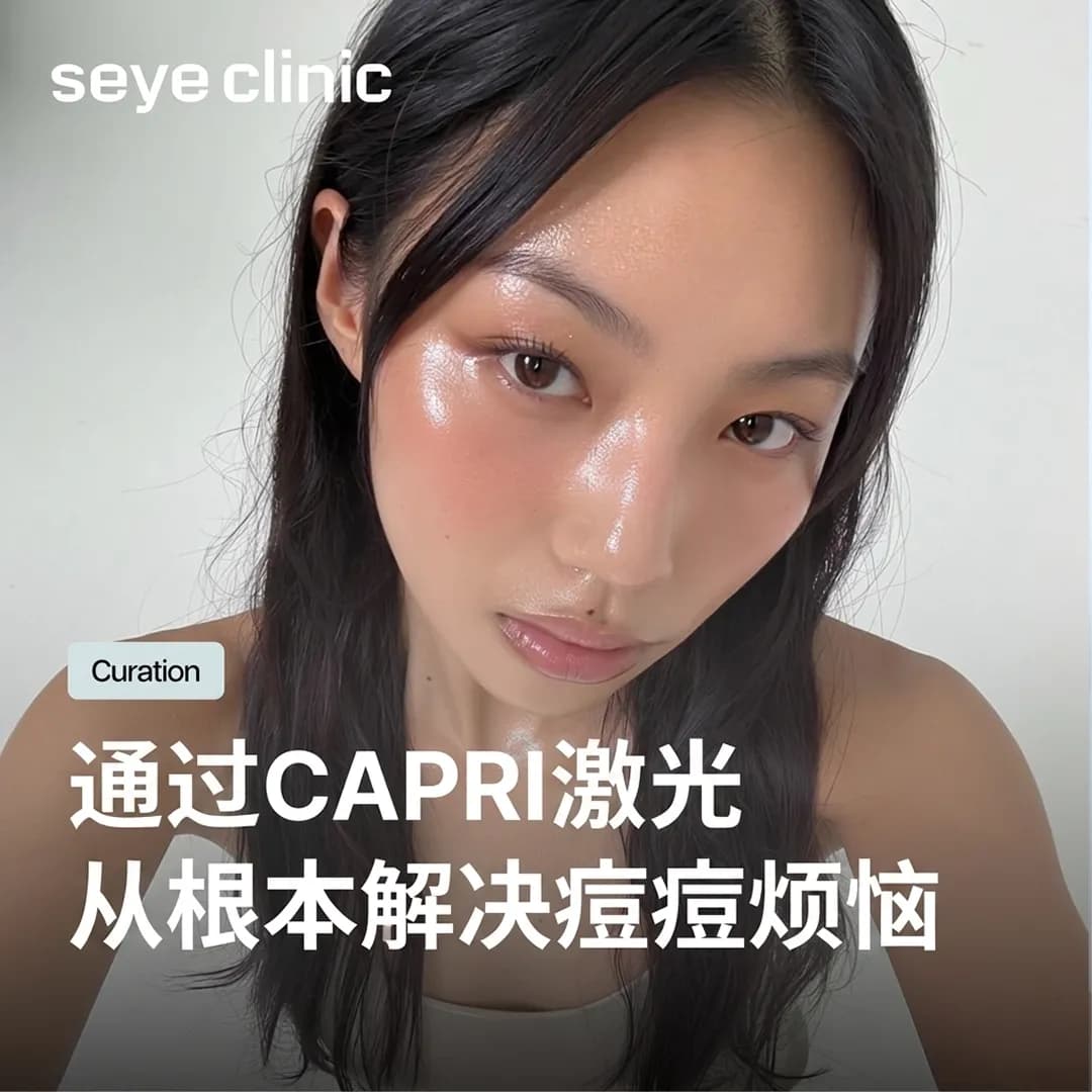 【韩国医美】首尔皮肤科推荐:通过Capri激光从根本解决痘痘烦恼!效果与恢复期全解析|韩国SeyeClinic世颜皮肤科诊所