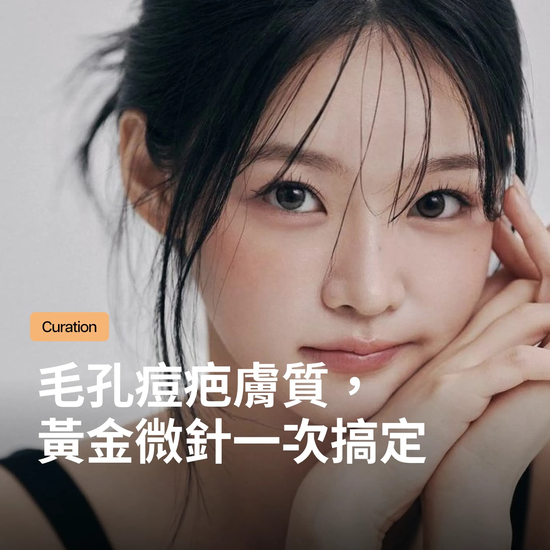韓國黃金微針為什麼這麼紅?毛孔、痘疤、膚質三个問題一次解析