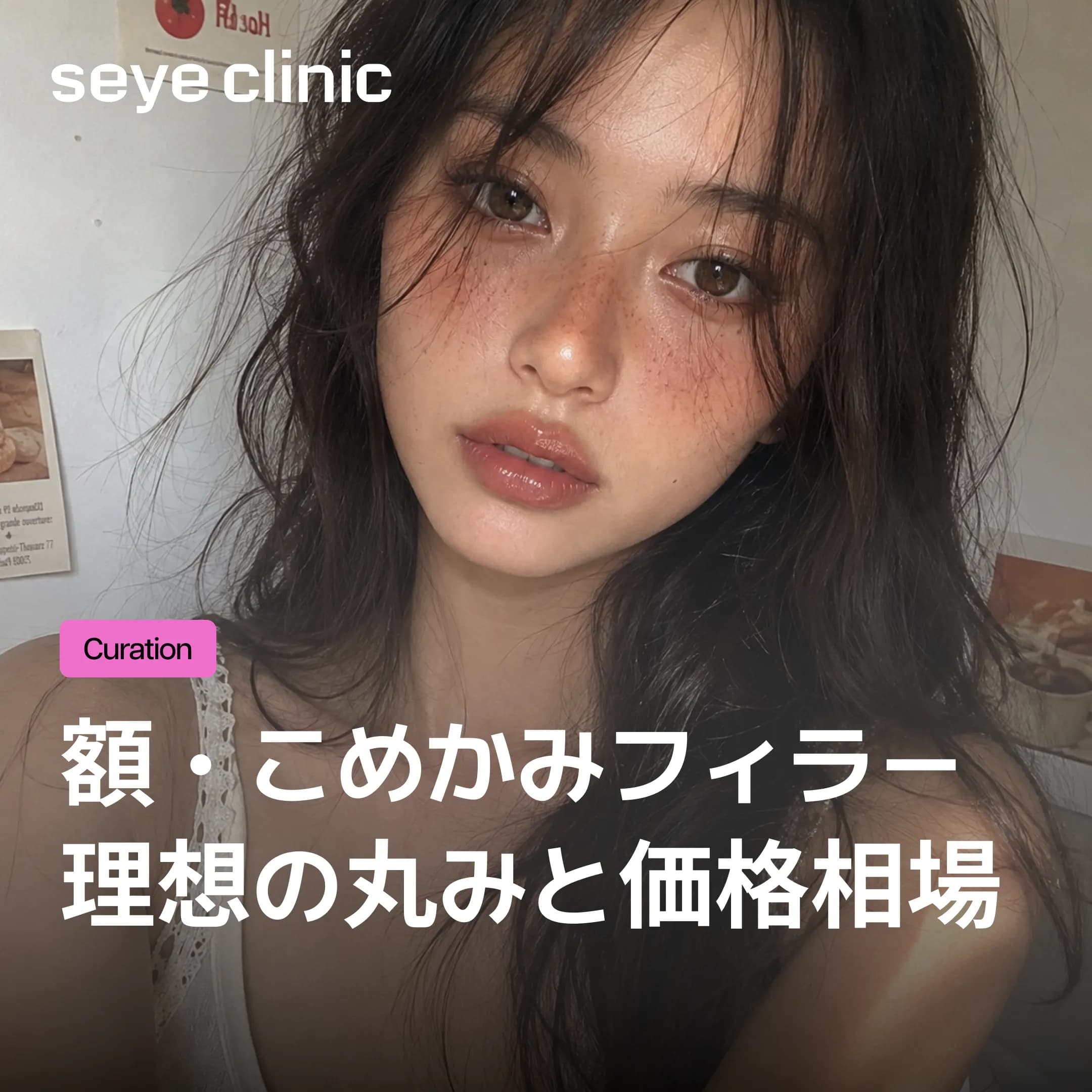 額・こめかみフィラーの費用・価格相場は?必要cc数と持続期間を韓国美容クリニックが解説