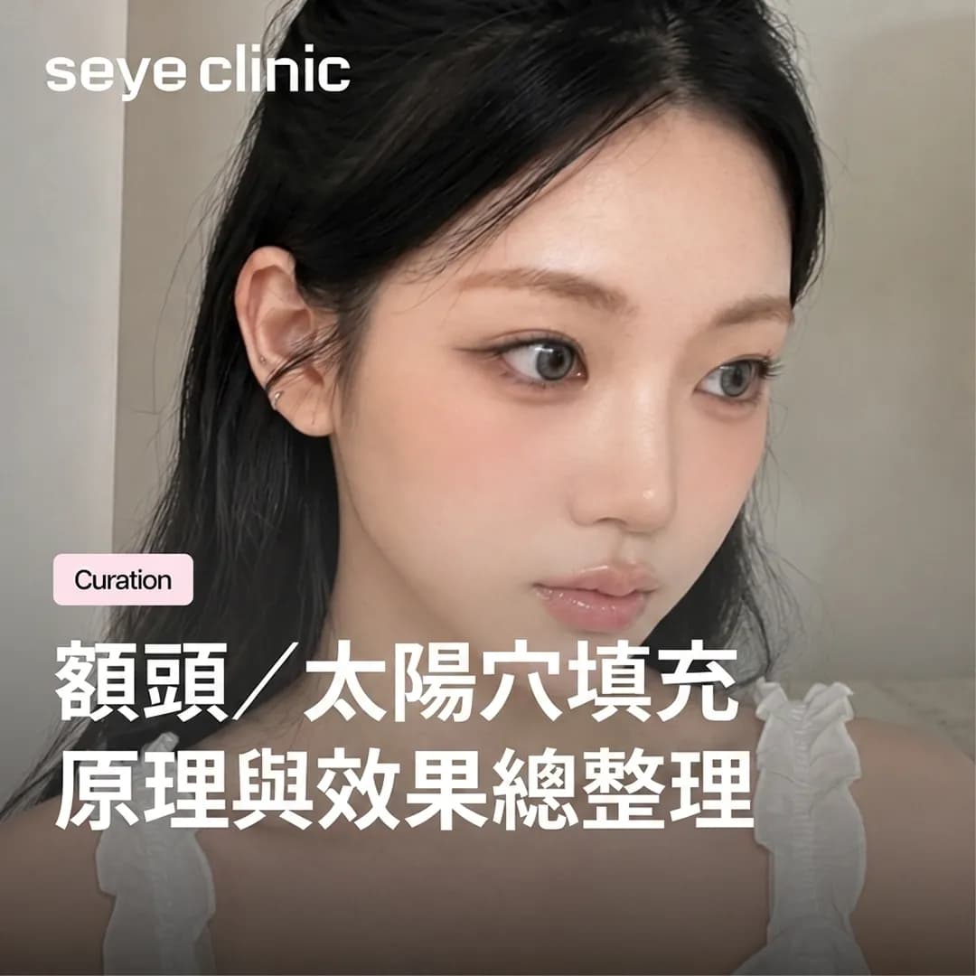 韓國醫美診所|首爾世顏診所:額頭太陽穴填充是什麼?原理、效果與輪廓塑形總整理