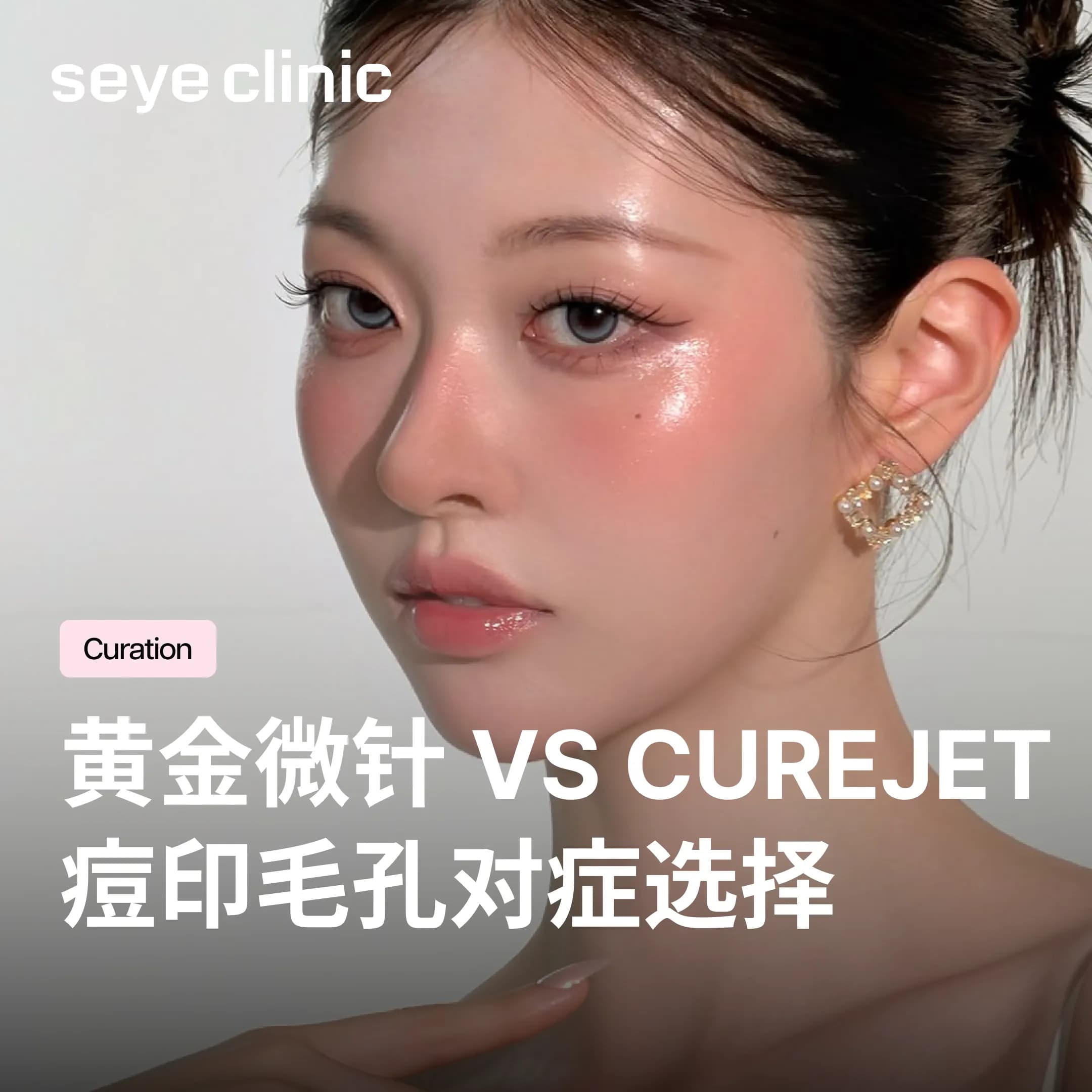 毛孔粗大、痘痘、痘印如何选择疗程?黄金微针VS CUREJET酷捷,对症下药才有效