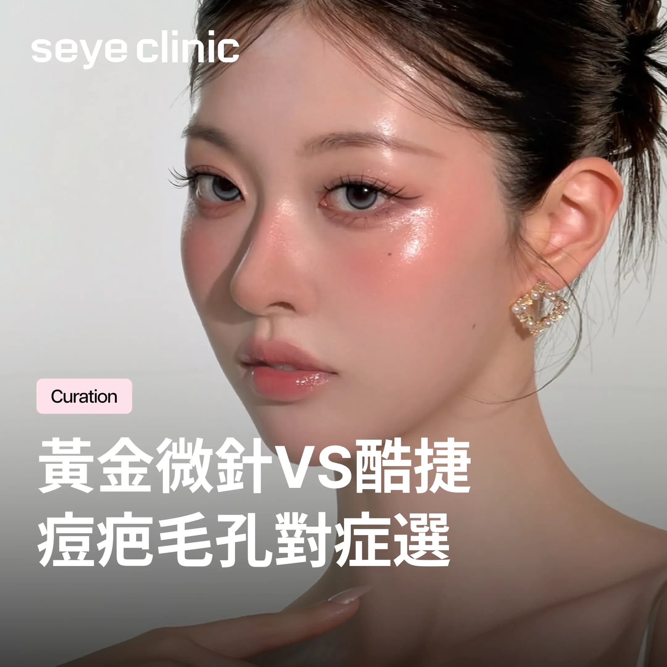 毛孔粗大、痘痘、痘疤怎麼選療程?黃金微針vs CUREJET酷捷,對症下藥才有效