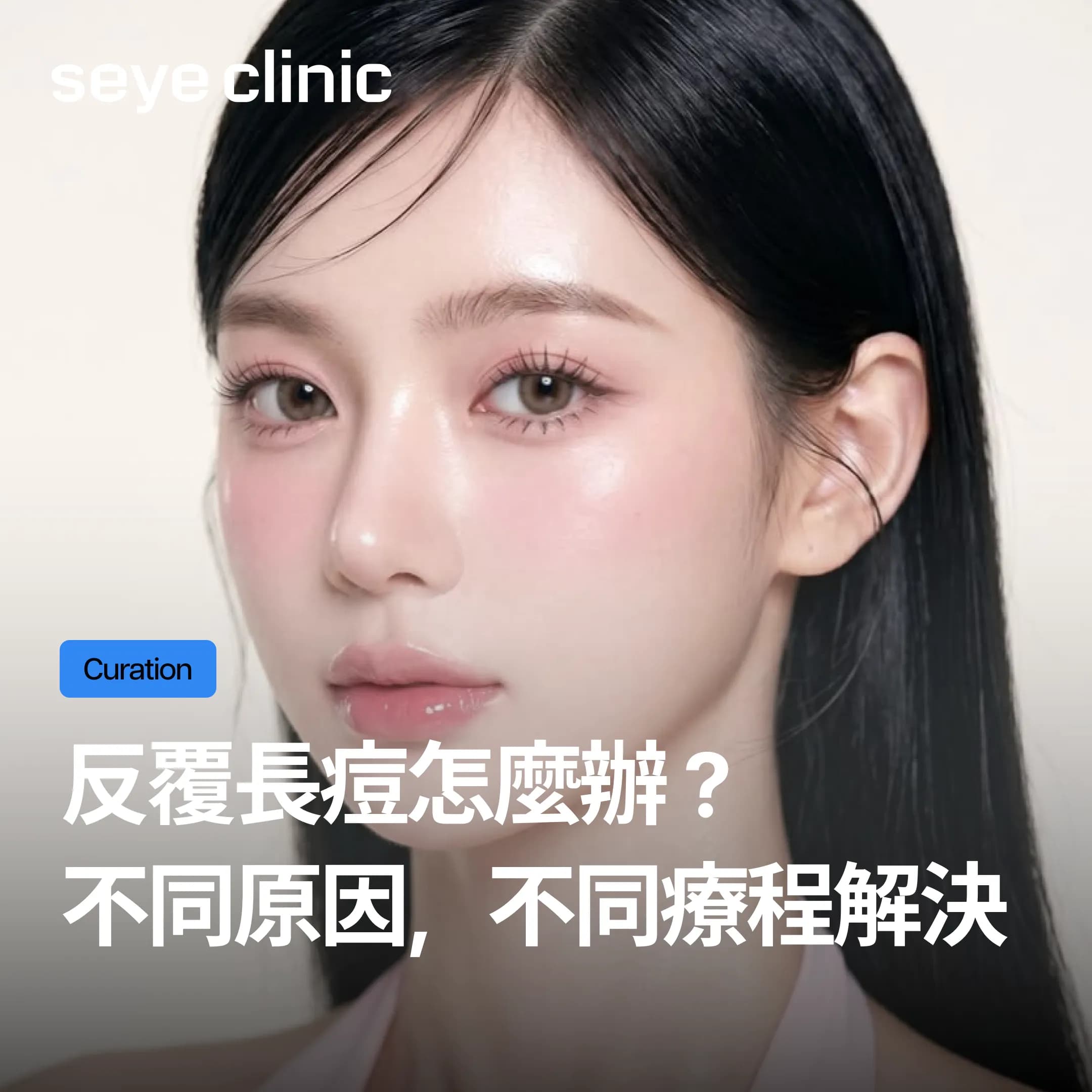 長期反覆長痘的人,黃金微針到底有沒有用?做幾次才有效?