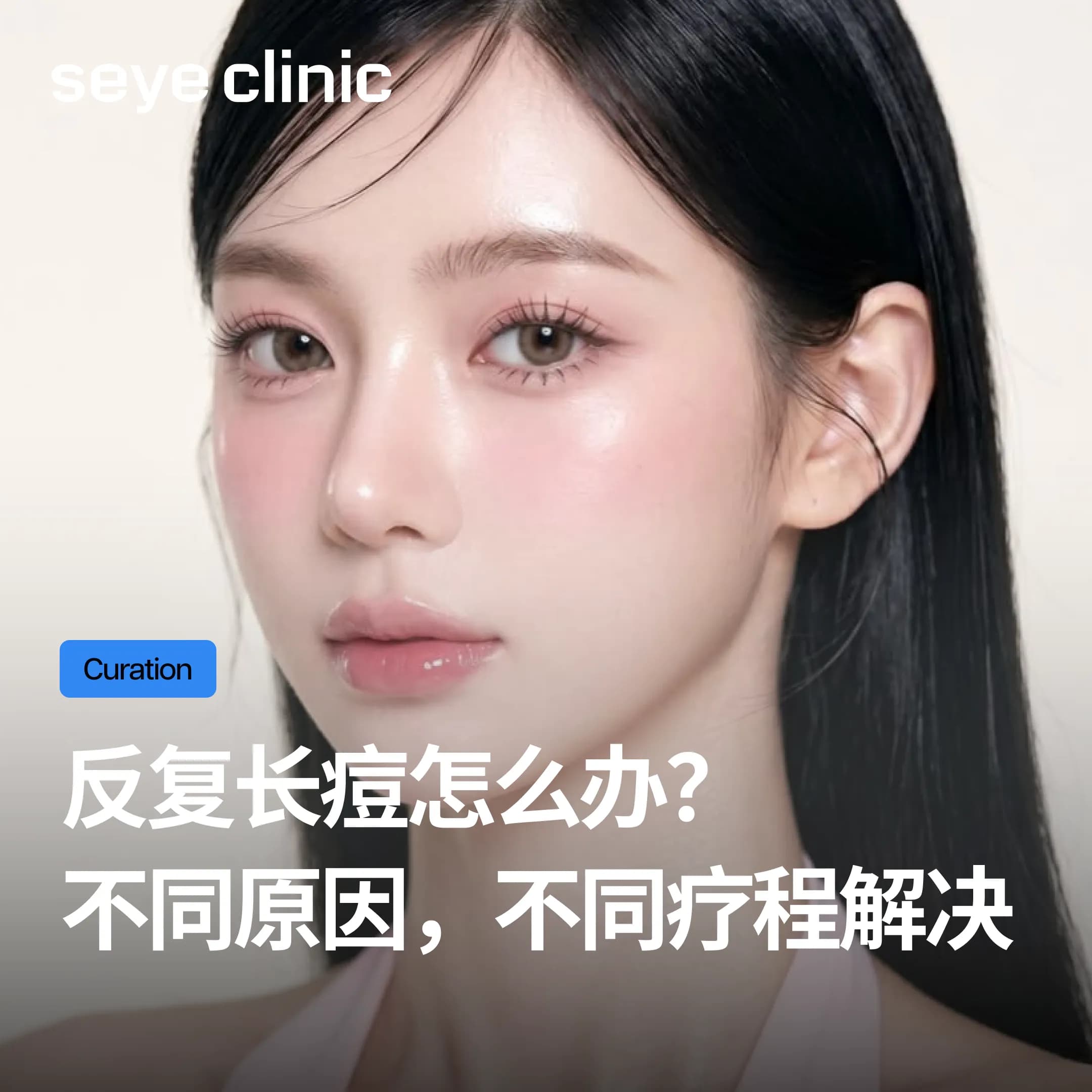 长期反复长痘的人,黄金微针到底有没有用?做几次才有效?韩国SeyeClinic世颜皮肤科诊所深度解析