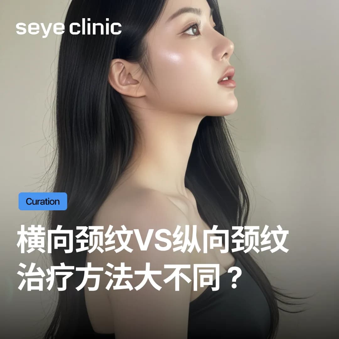 横向颈纹vs纵向颈纹,治疗方法大不同?颈纹玻尿酸与年轮针各类型攻略法