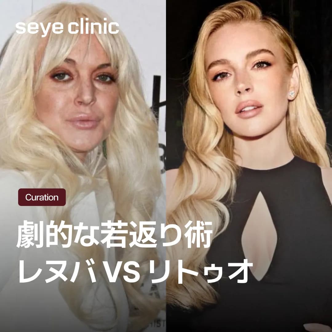 レヌバとRe2O(リトゥオ)の違いとは?肌密度を高めるECM再生術を徹底比較