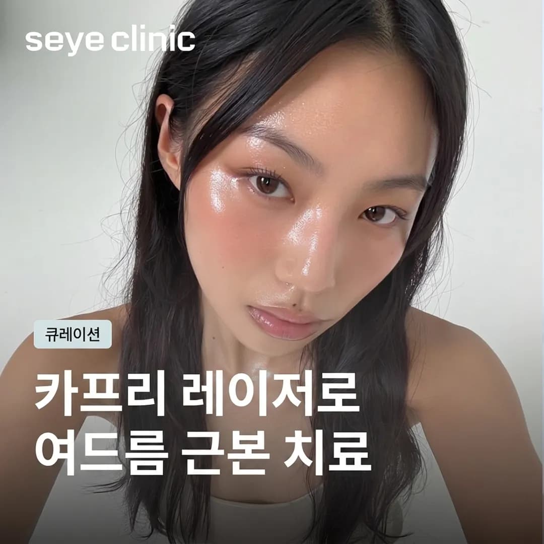 강남 카프리 레이저: 다운타임 없이 여드름의 근본 원인을 치료하다