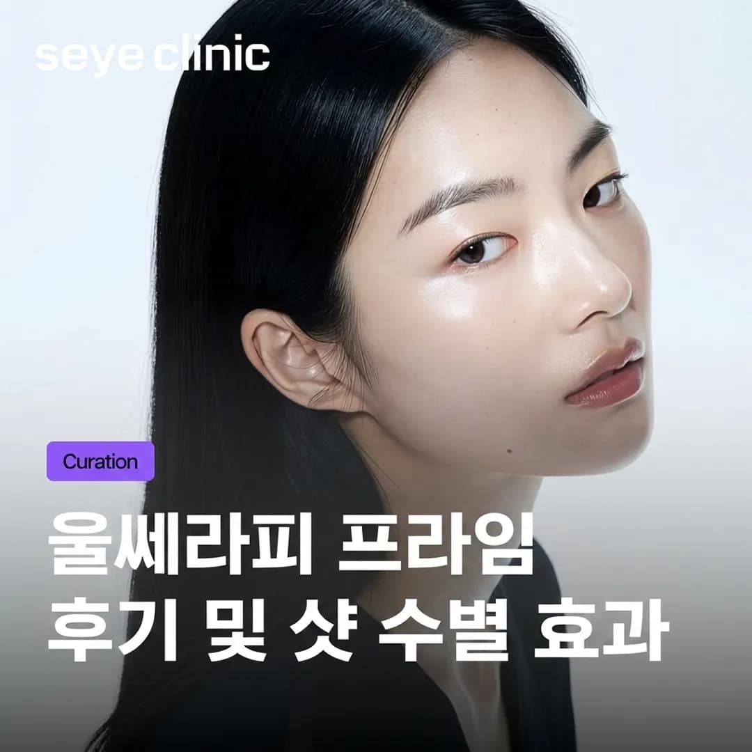 울쎄라 프라임 후기: 샷 수별 효과와 후회 없는 선택 가이드