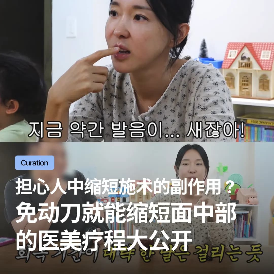 担心人中缩短施术的副作用?免动刀就能缩短面中部的医美疗程大公开