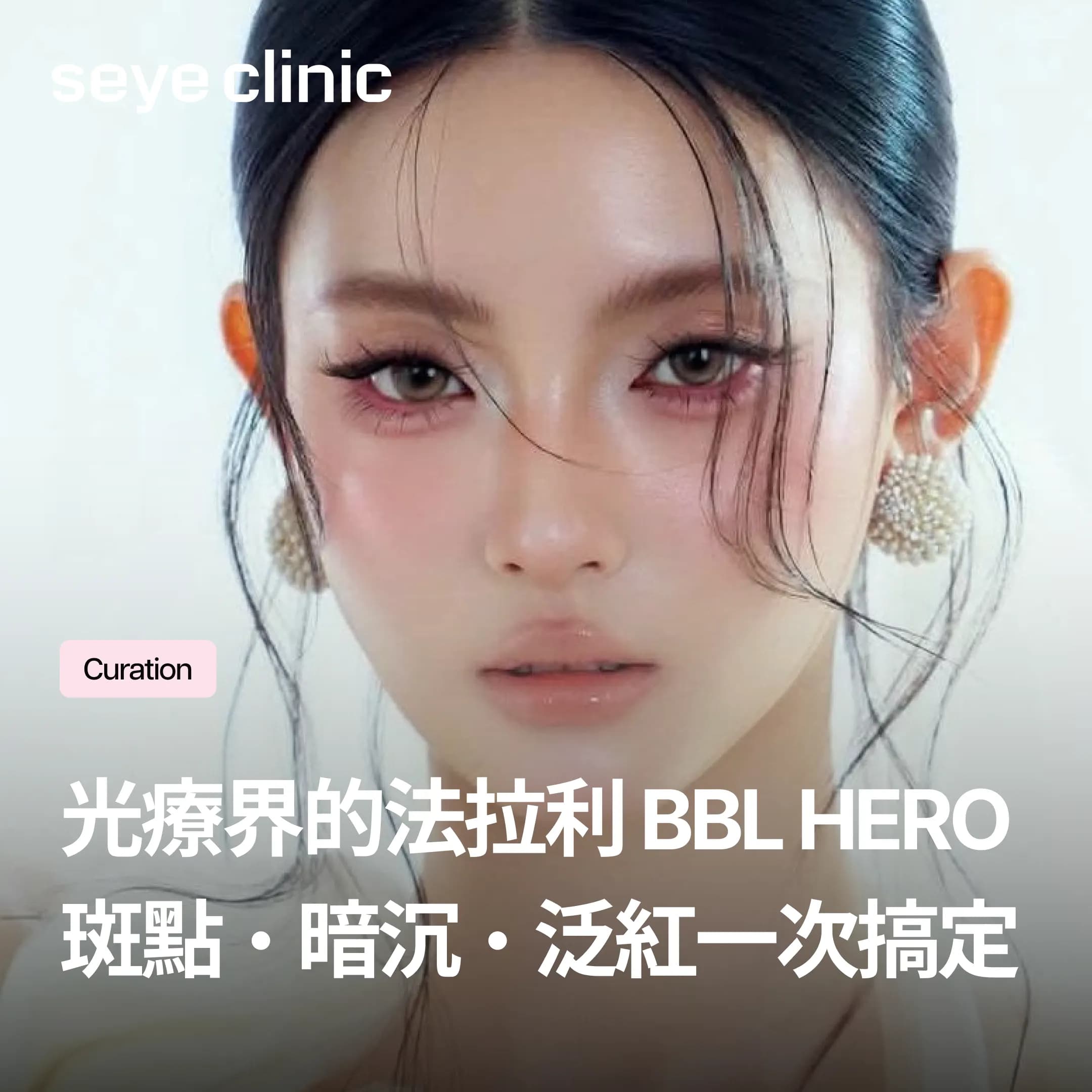 BBL HERO真的有效嗎?跟脈衝光差在哪?斑點、暗沉、泛紅效果解析——韓國首爾世顏皮膚科