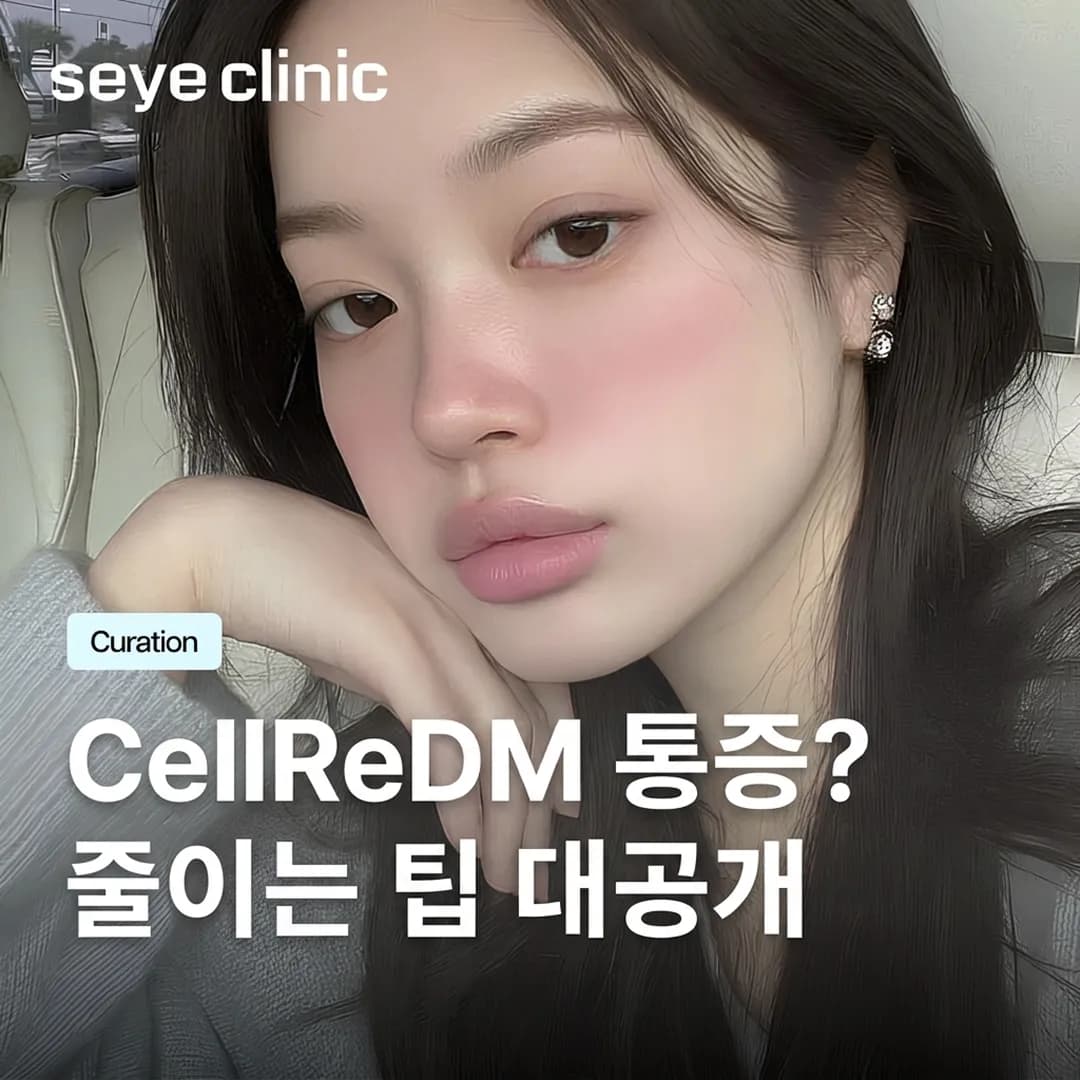 셀르디엠 통증: 다운타임 최소화 및 통증 관리 완벽 가이드