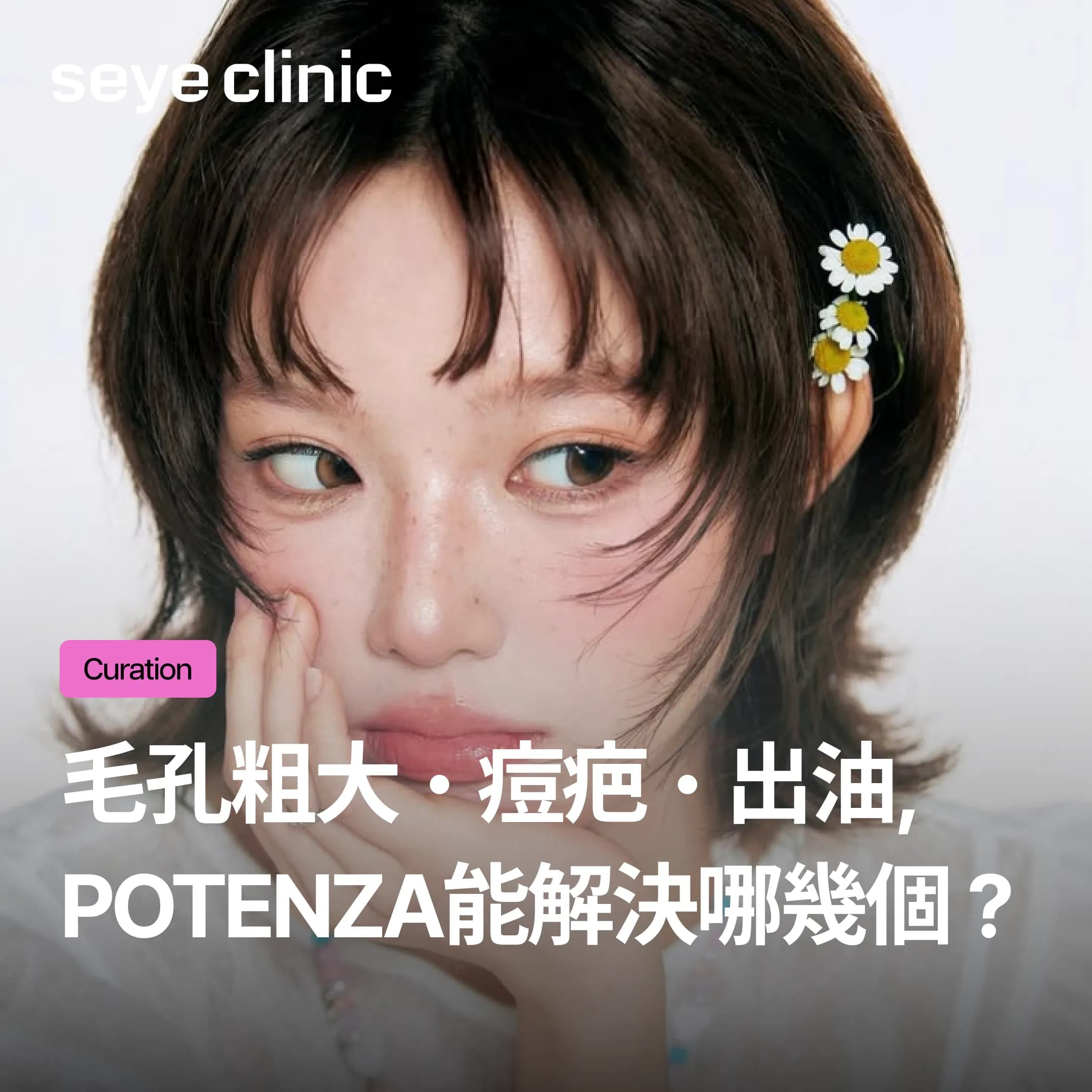 黃金微針Potenza有沒有用?做幾次才有感?副作用、恢復期與適合族群