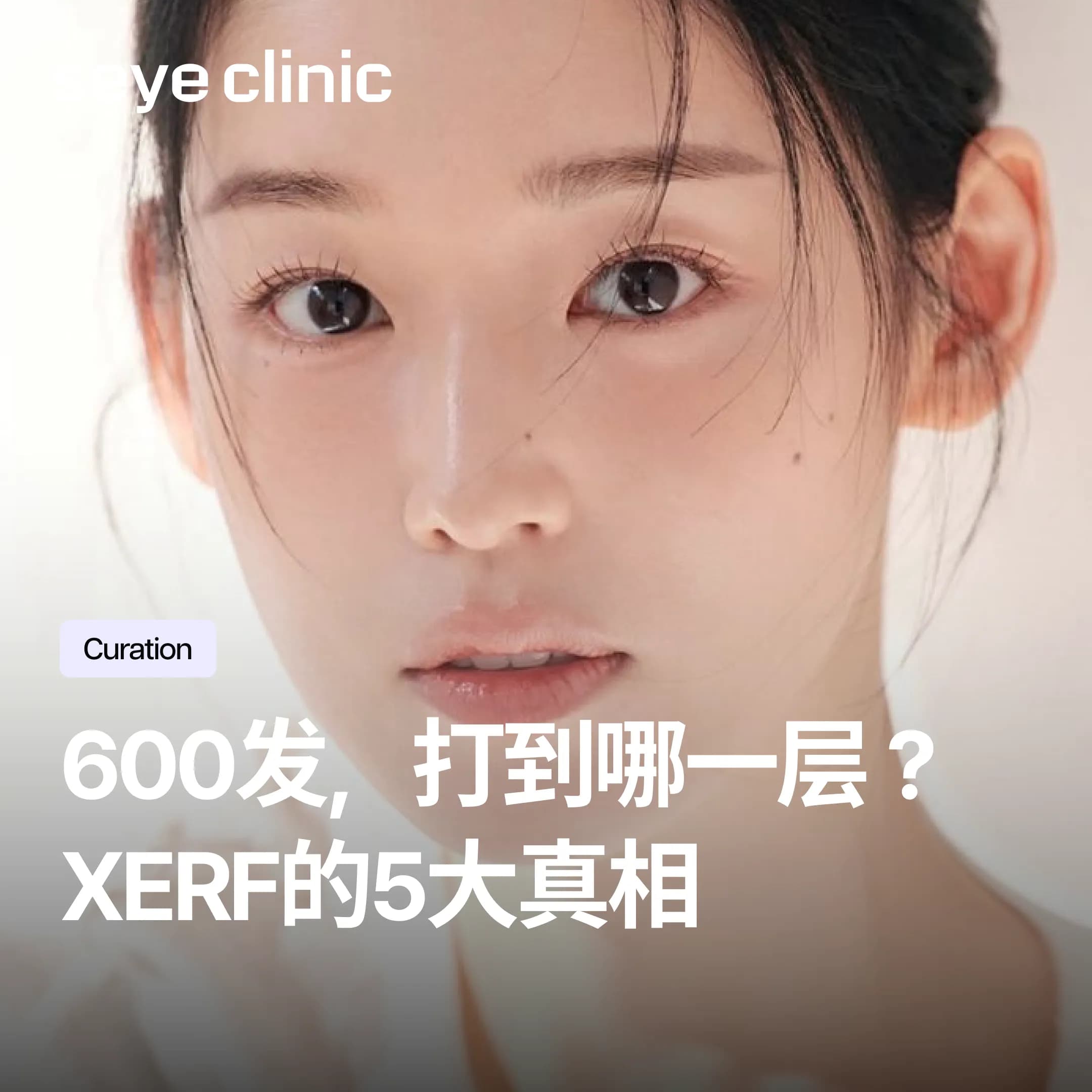 韩国SeyeClinic世颜皮肤科诊所:同样600发热超联合,为何你没效?XERF双频电波5大真相