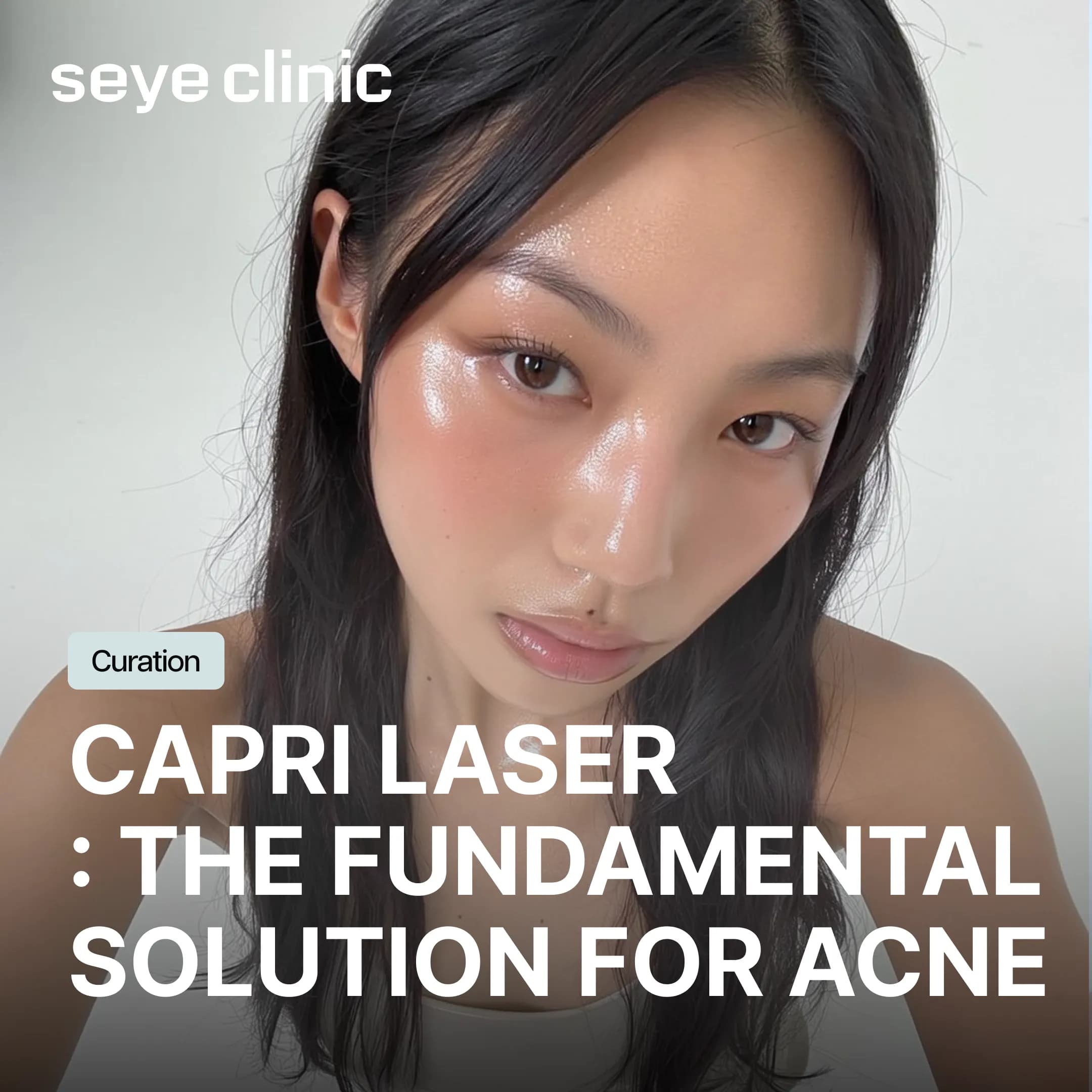 Capri Laser in Gangnam: Destroying Acne at the Source Without Downtime