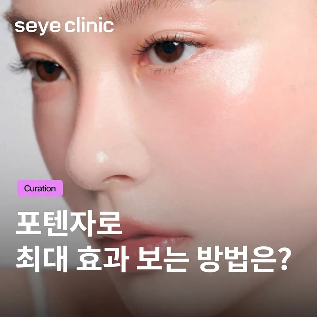 포텐자(Potenza): 모공, 여드름 흉터, 피부 탄력 고민을 해결하는 황금 마이크로니들 RF의 모든 것