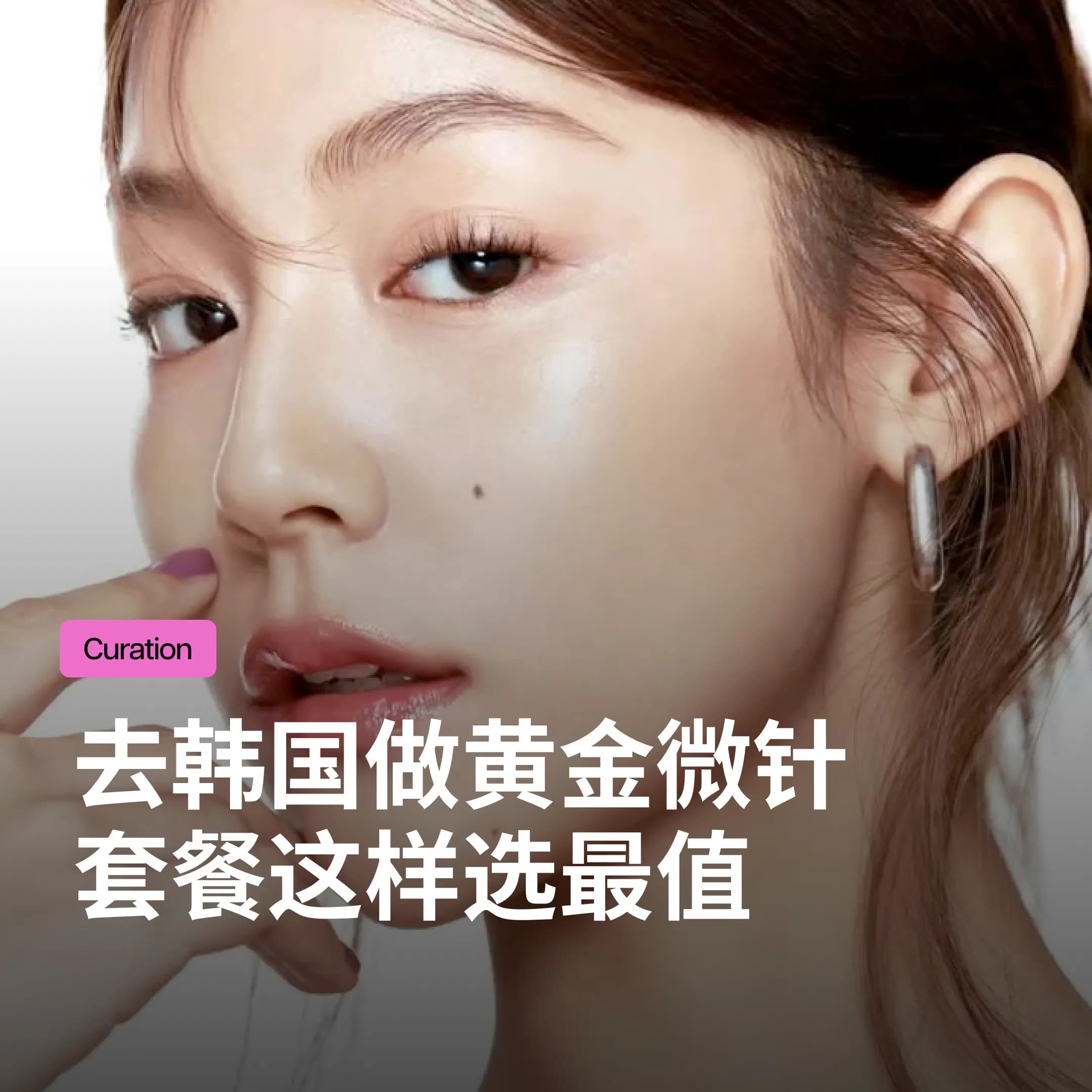 韩国医美|首尔皮肤科黄金微针Potenza:N针、CP针、Agnes探头区别与世颜诊所套餐推荐