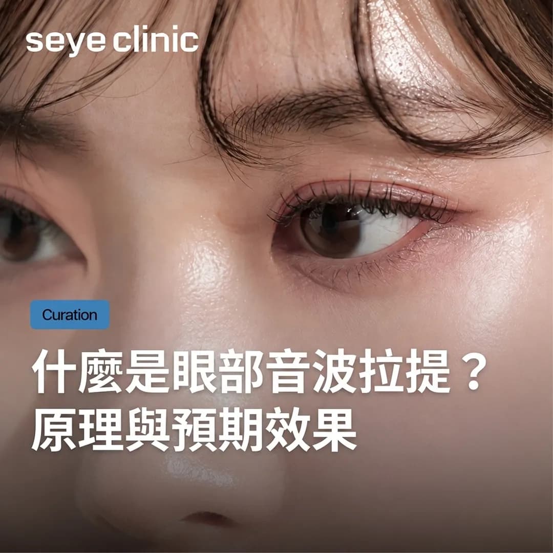 韓國醫美診所推薦:眼部美國音波拉提是什麼?原理與緊緻眼周效果解析
