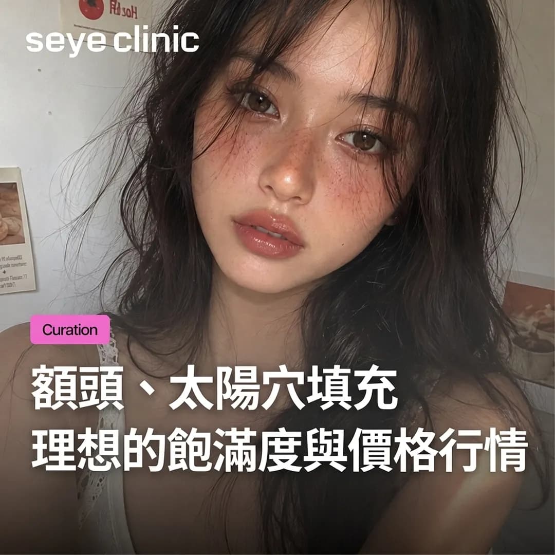 韓國醫美|首爾世顏診所:額頭、太陽穴玻尿酸填充費用、所需cc數與維持期間解析