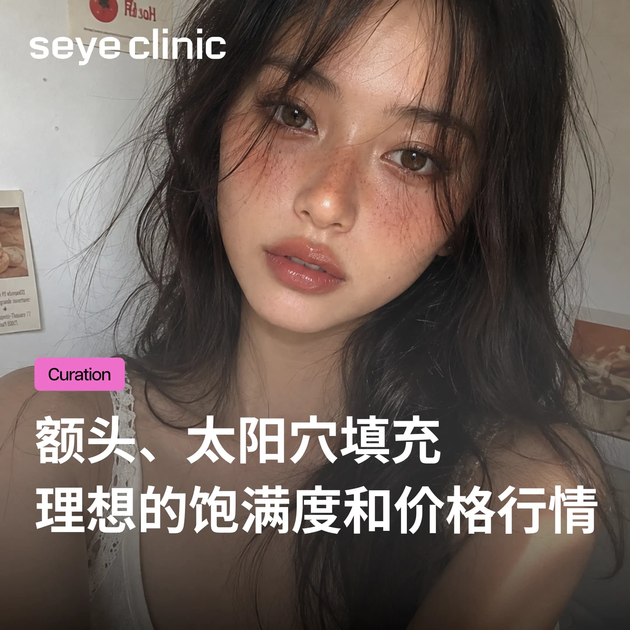 韩国医美|首尔世颜诊所:额头、太阳穴玻尿酸填充费用、所需cc数与维持期间解析