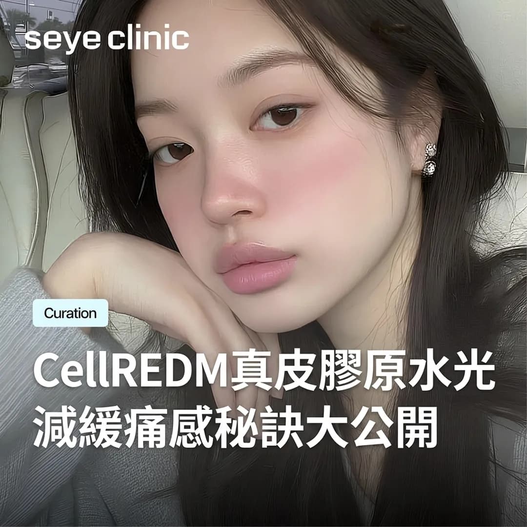 韓國醫美|CellREDM真皮膠原水光會痛嗎?首爾世顏診所減緩痛感秘訣大公開