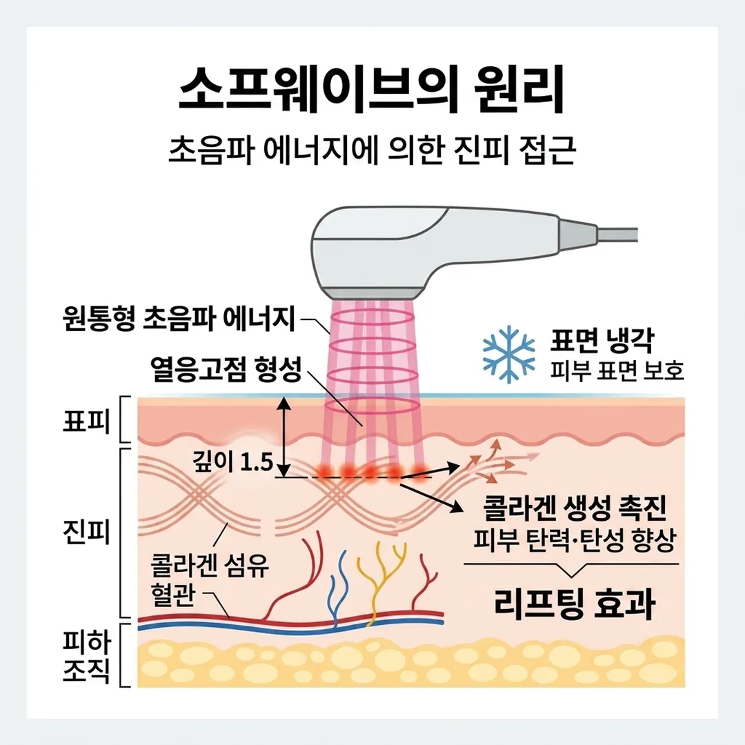 소프웨이브원리-1.webp