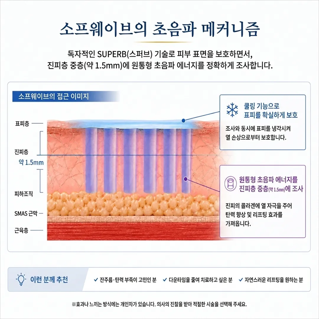 소프웨이브원리_2.webp