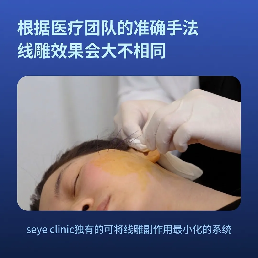 실루엣소프트-seye-clinic-clinic独有的可将线雕副作用最小化的系统-根据医疗团队的准确手法-线雕效果会大不相同-zh-cn.webp