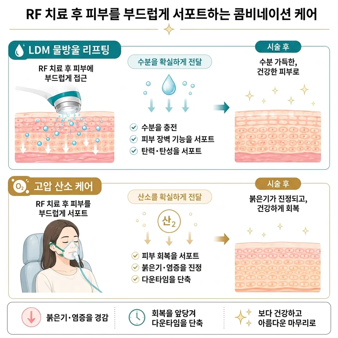 써마지, 올리지오 원리.webp