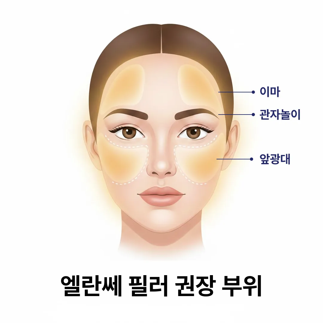 엘란쎄 필러 부위.webp