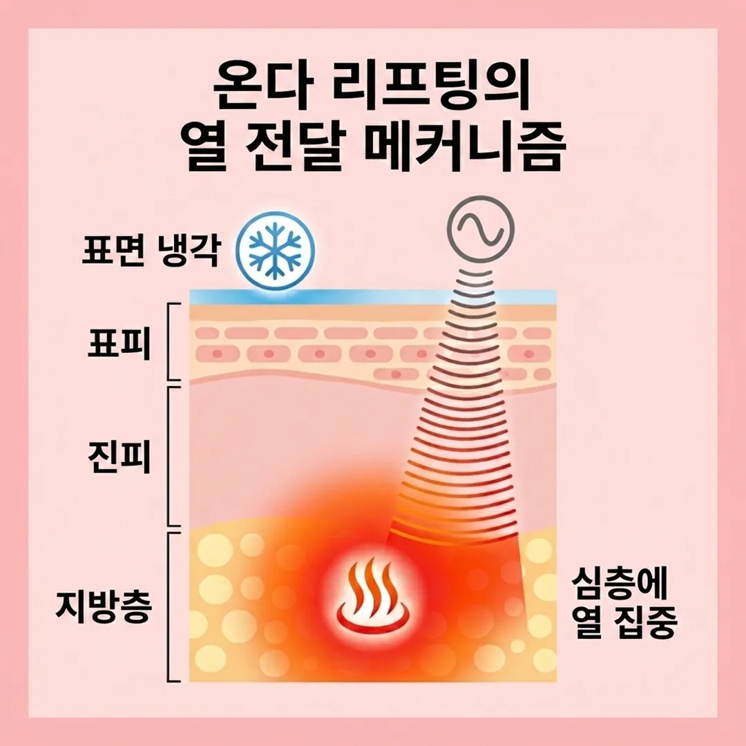 온다리프팅 원리_2.webp