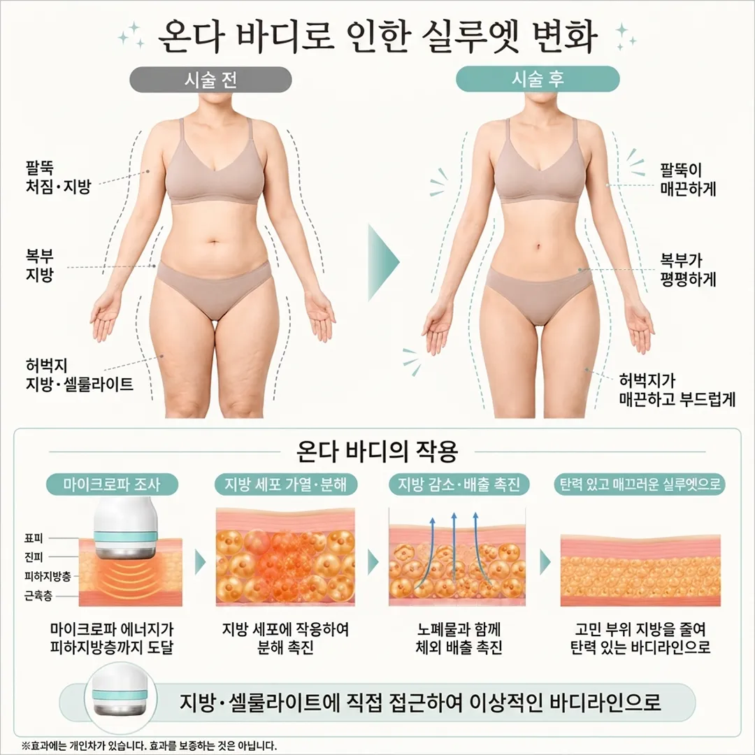 온다바디효과및 원리.webp