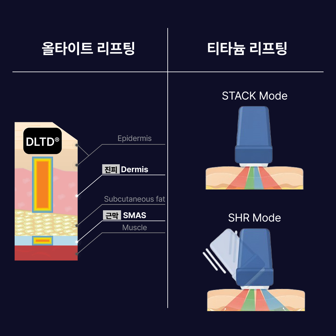 올타이트 티타늄 원리 비교.png