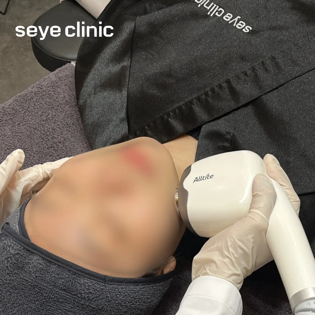 올타이트 후기 병원.webp