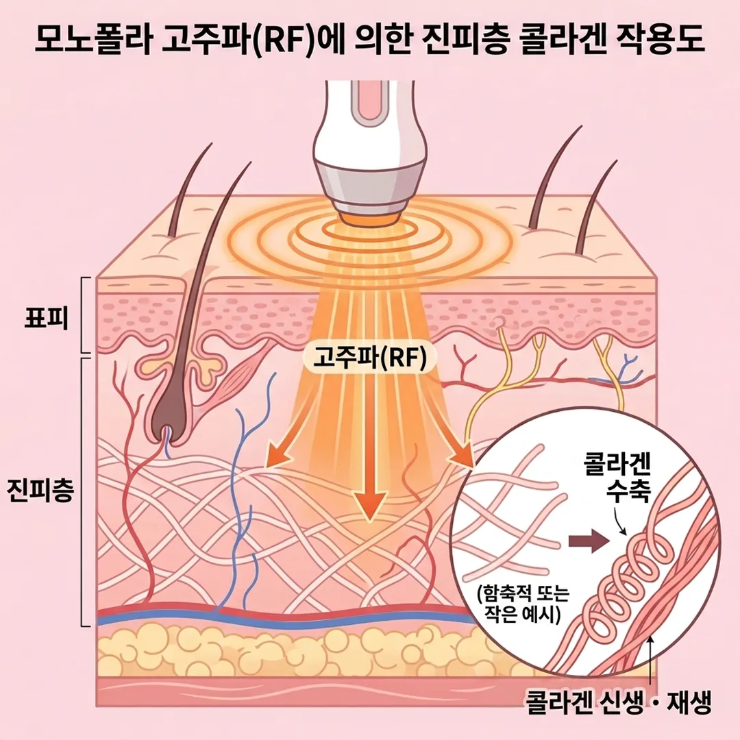 올타이트_피부층.webp