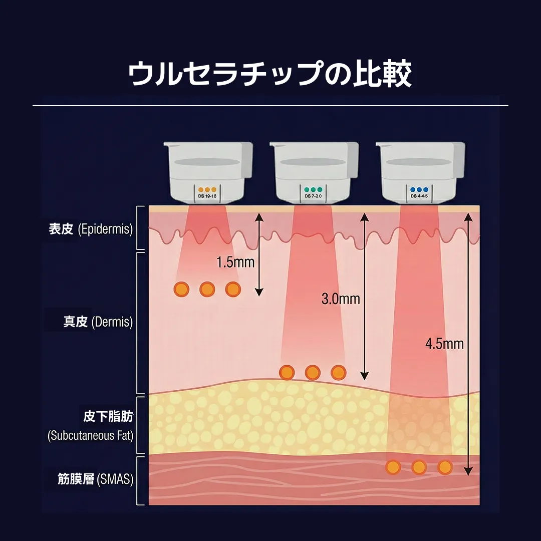 울쎄라 팁 비교-3.webp